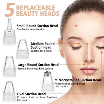 Blackhead Remover Vacuum – Electric Pore Cleaner with 6 Suction Heads